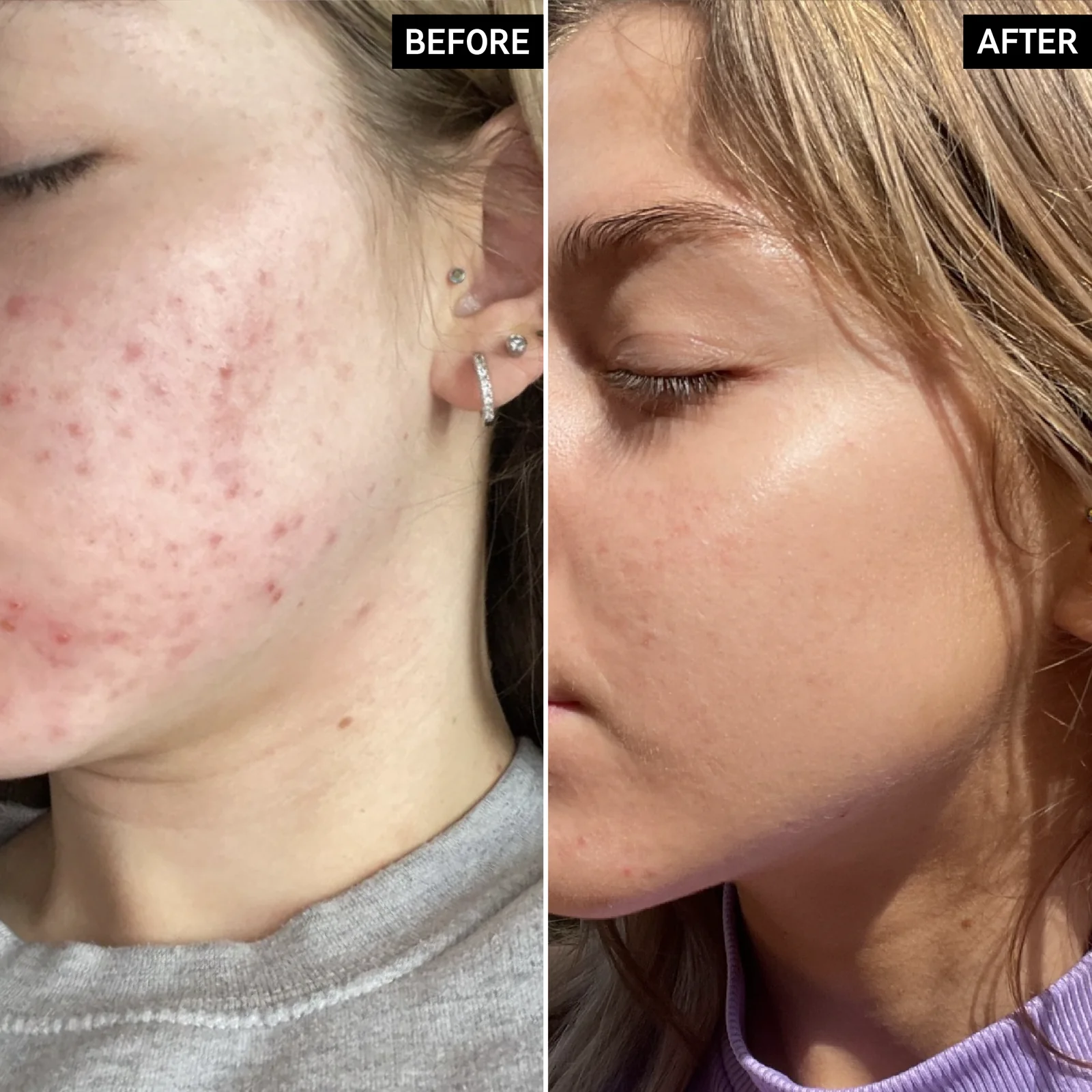 سرم نیاسینامید